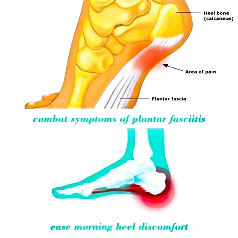 1 Pair Anti-Fatigue Socks